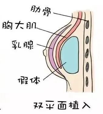 男性情趣用品