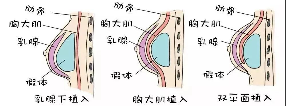 男性情趣用品