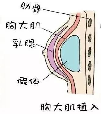 男性情趣用品